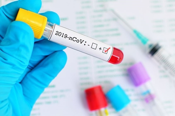 &Theta;&epsilon;&tau;&iota;&kappa;ό&sigmaf; &sigma;&epsilon; &epsilon;&xi;έ&tau;&alpha;&sigma;&eta; COVID &ndash; 19 &beta;&rho;έ&theta;&eta;&kappa;&epsilon; &upsilon;&pi;ά&lambda;&lambda;&eta;&lambda;&omicron;&sigmaf; &tau;&omicron;&upsilon; &Delta;ή&mu;&omicron;&upsilon;